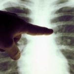 39048703canc-20010809-00178-jpg-720x340_1546244572-6780035