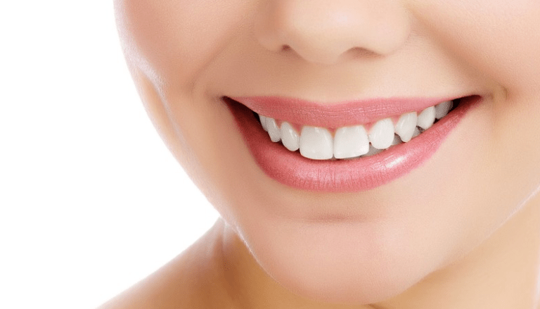 8 mënyra natyrale për t’i bërë dhëmbët tuaj më të bardhë