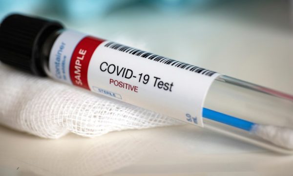 Vaksina për COVID-19 e zhvilluar nga firma amerikane Moderna hyn në fazën përfundimtare të testimit