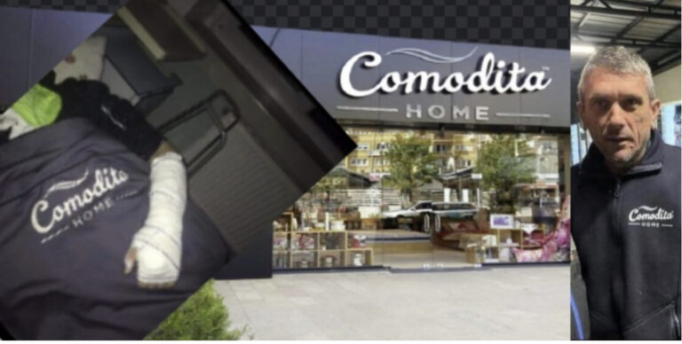 Menaxheri i “Comodita Home” e bën për spital punëtorin 18 vjeçar, e rrahu dhe i theu dorën se “nuk punoi shpejt”