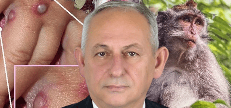 Infektologu kosovar jep lajmin e frikshëm, Kosova rrezikohet nga paraqitja e rasteve të lisë së majmunëve